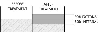 Anodizing thickness